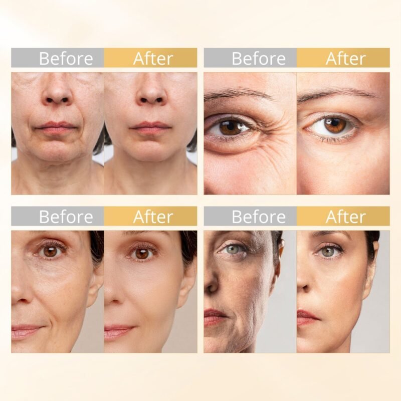 6 in 1 RF Microcurrent Facial Device, Homeuse Skin Tightening Rejuvenation Facial Massager Face Lifting Skin Care Tool for Reduce Wrinkles,Skin Care,Light Therapy,Anti Aging Device,Unisex Gift